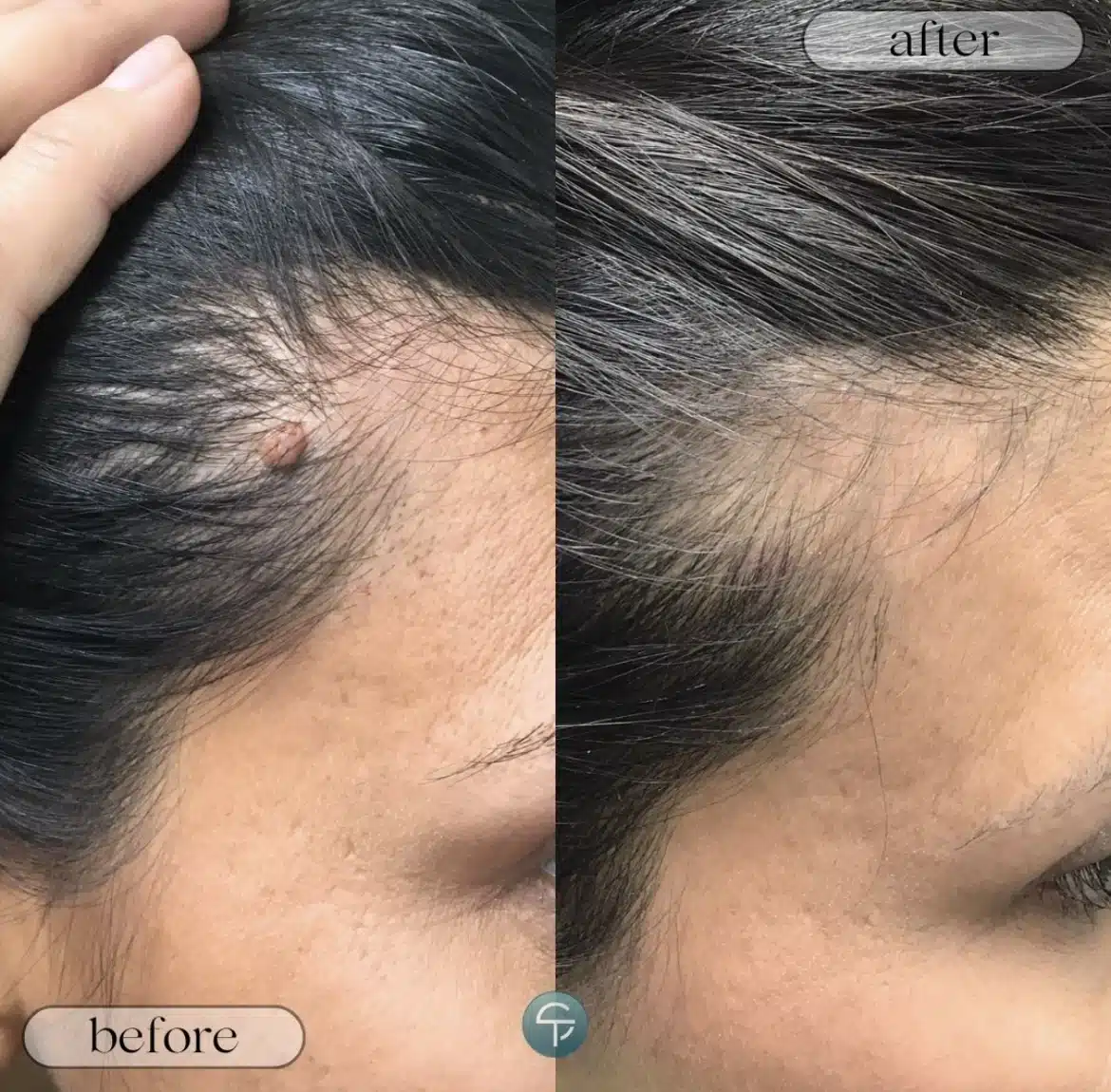 Skintellect Laser & Aesthetics | Tampa Florida